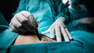 Fue condenado el cirujano que grabó sus iniciales en los hígados de sus pacientes