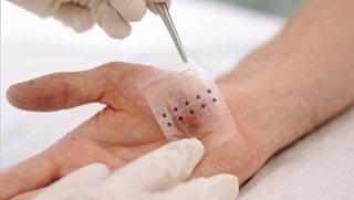 Diabetes: imprimirán parches con antibióticos para favorecer la cicatrización de las heridas