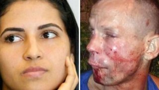 Intentó robarle el celular a una luchadora de UFC y terminó con el rostro destrozado