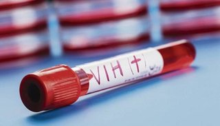 Una mujer argentina se habría curado de VIH por inmunidad natural