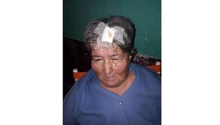 Una abuela fue golpeada por su hija y necesita ayuda