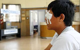 Un adolescente herido muy cerca del ojo izquierdo