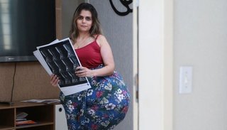 Una enfermedad genética le duplicó el tamaño de las piernas y debe operarse cada tres años