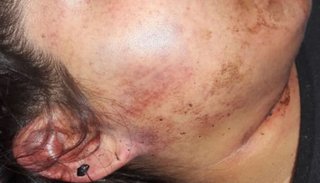Víctima clama una carátula conforme a los hechos