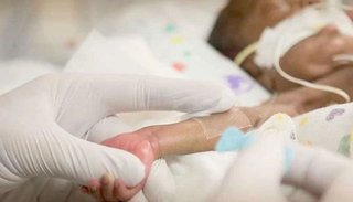 Conmoción en Colombia: una beba nació “embarazada” de su hermano gemelo