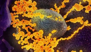 Coronavirus: cómo se contagia, cuáles son los síntomas y cómo prevenirlo