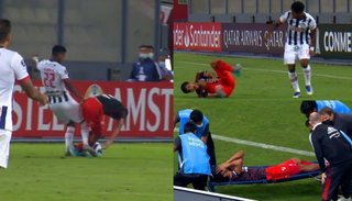 Robert Rojas será operado este sábado de su fractura de tibia y peroné