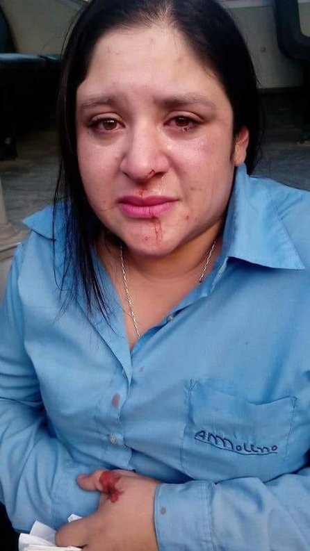 Cobarde agresión: golpearon a una chofer del corredor 7E- Cobarde agresión: golpearon a una chofer del corredor 7E