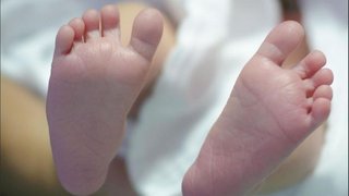 El extraño caso de un bebé que nació con cola de doce centímetros