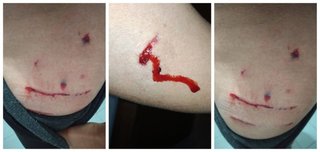 Jujeña denunció que es atacada todos los días por perros asesinos en el barrio Bellavista