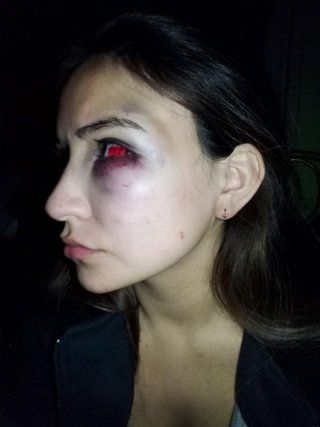 Recuperó la libertad el agresor de Belén Rojas