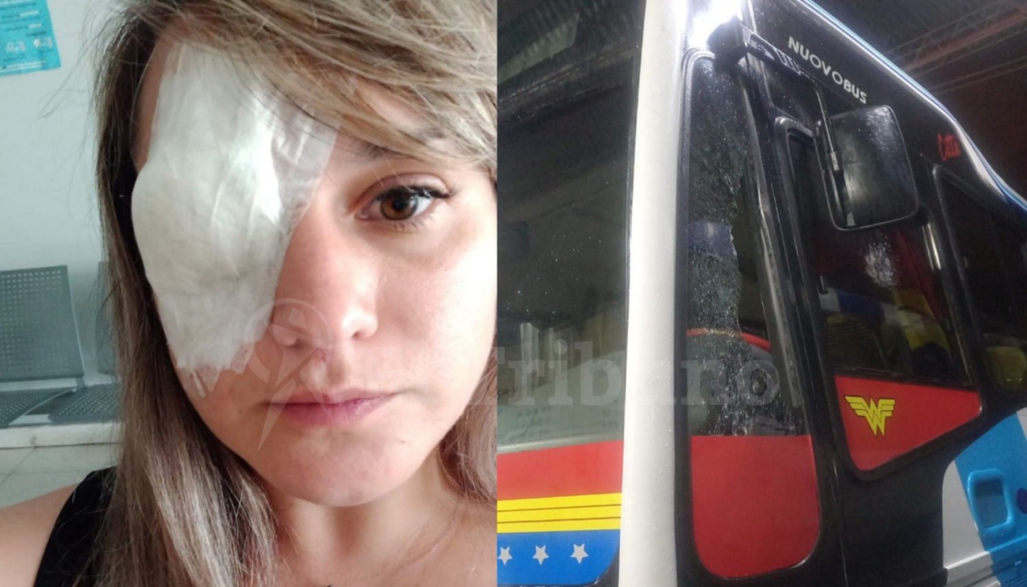 Romina, la chofer valiente que quedó con secuelas tras un ataque cobarde
