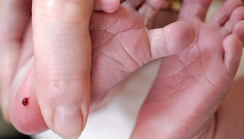 El test del talón, fundamental para la detección de la fibrosis quística