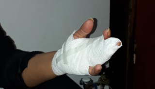 En Pichanal, un secretario del intendente Jalit le rompió los dedos a una concejala