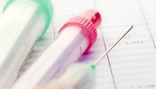 Con un análisis de sangre se puede predecir el cáncer de pulmón