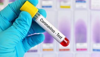 Hoy se confirmaron 220 nuevos casos de coronavirus en Salta