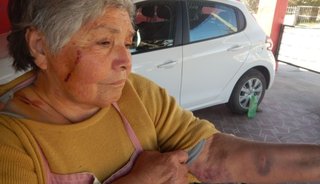 Un perro atacó a una abuela y la salvaron los vecinos