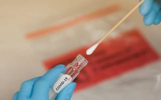 El Gobierno informó 29 muertes más y cambió la definición de caso positivo