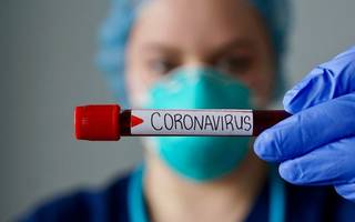 CORONAVIRUS: Hoy se registraron 7.187 nuevos casos en el país y 104 muertes en las últimas 24 horas