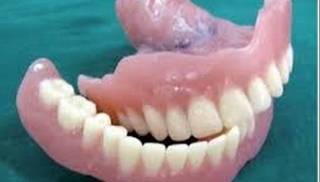Los dientes y prótesis en mal estado aumentan el riesgo de cáncer bucal