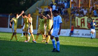 Mala tarde para Gimnasia: a la derrota se le sumó la lesión de Ibarlucea