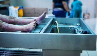 Estaba “muerto”, despertó en la morgue y volvió a la fiesta donde sufrió un coma