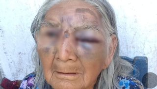 La Policía investiga violento ataque a una señora de 70 años