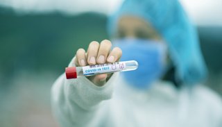 Confirmaron hoy 105 nuevos casos de coronavirus en Salta