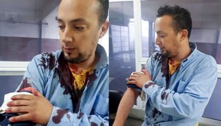 Un ladrón atacó a un colectivero para robarle