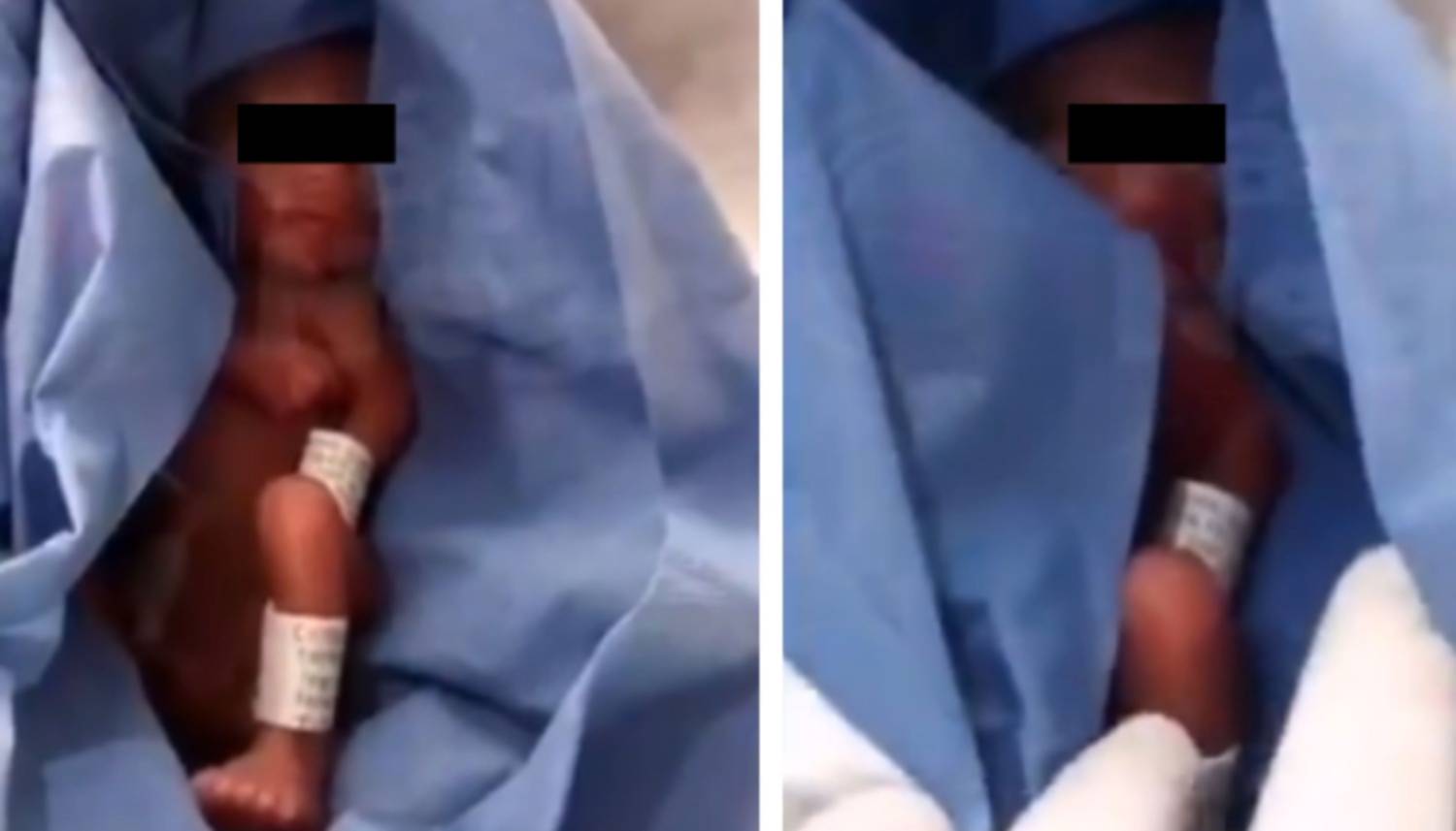 Video Dieron Por Muerto A Un Bebe Prematuro Y Su Padre Descubrio Que Estaba Vivo
