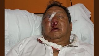 Golpeado por todos lados: el estado del inspector municipal atacado por un vendedor ambulante