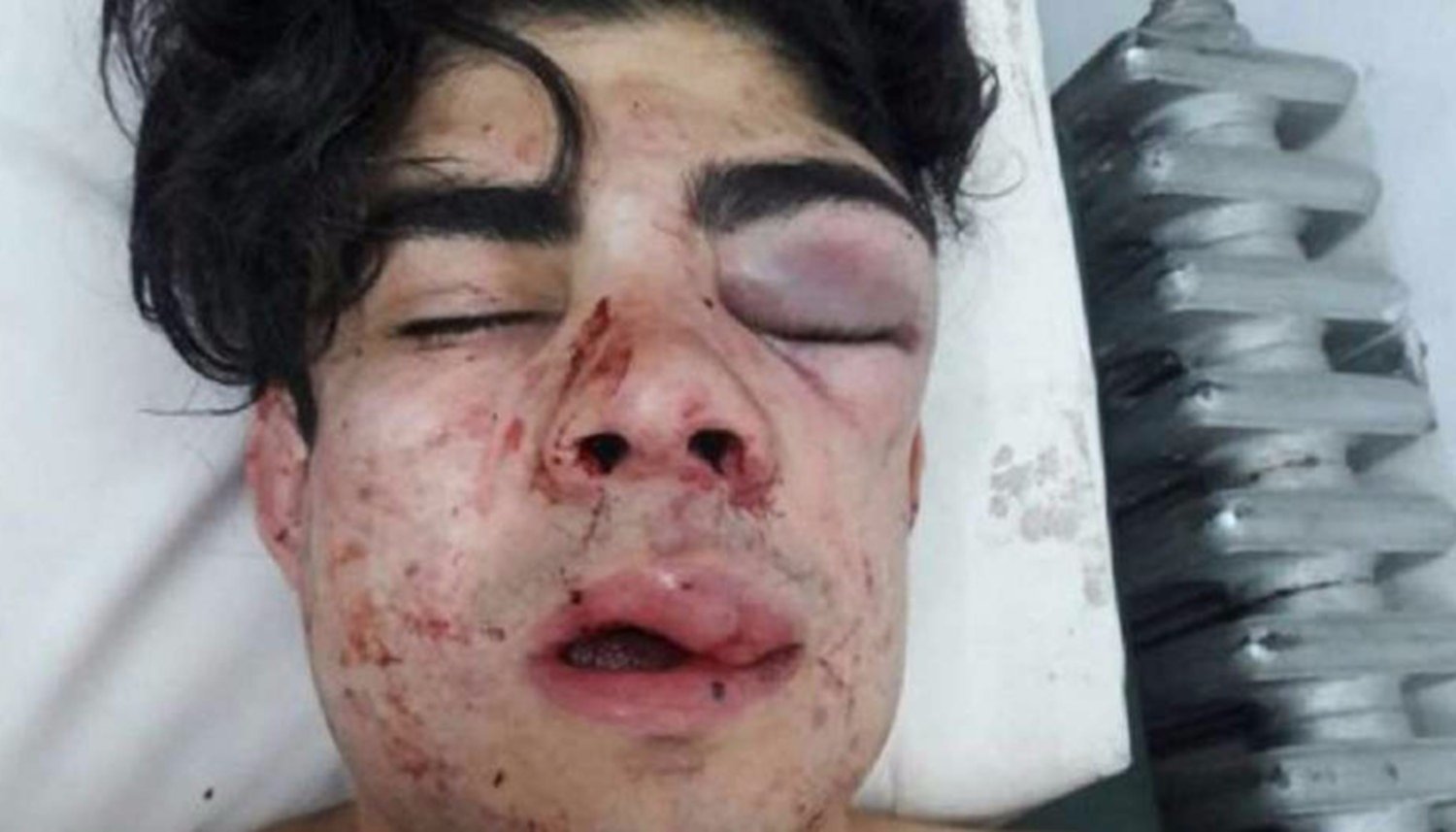 Desfiguran a un joven por su Desfiguran a un joven por su