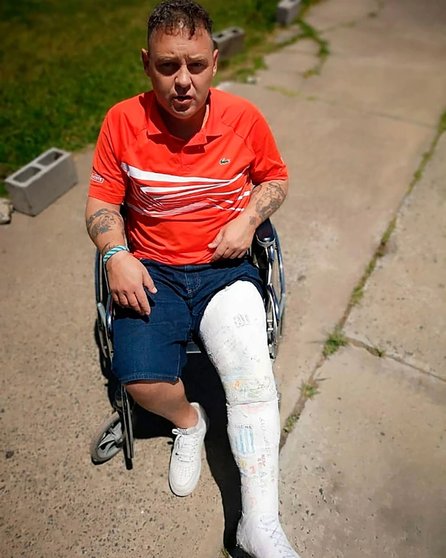 “El Pepo” se fracturó jugando al fútbol en la cárcel y deberá ser operado mañana- “El Pepo” se fracturó jugando al fútbol en la cárcel y deberá ser operado mañana