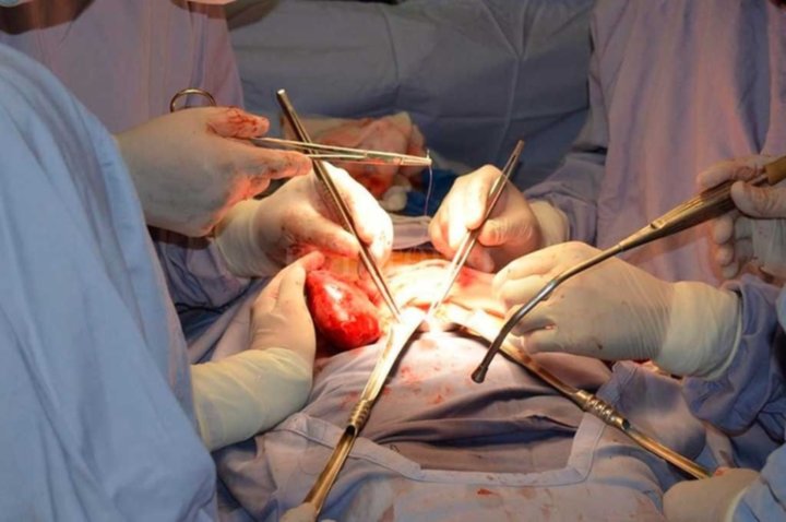 En el hospital Oñativia se realizaron dos nuevos trasplantes de riñón