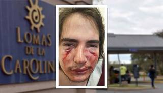 Tres rugbiers golpearon brutalmente a un joven en un country de Córdoba